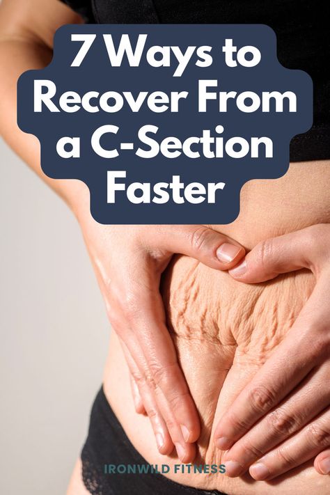 Wondering how to recover from a C-section faster? What are the best C-section tips for faster healing? Here are the 7 things I recommend having for better recovery. Heal From C Section, Work Out After C Section, C-section, C Section Recovery Exercise, Post C Section Recovery, Recovering From C Section, Cesarean Recovery, Healing From C Section, Postpartum Wellness