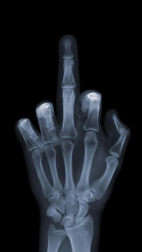 Hand X-Ray Middle Finger Wallpaper, Iphone 5 Wallpaper, Luxury Printing, Hd Phone Wallpapers, Free Iphone Wallpaper, Trendy Wallpaper, New Backgrounds, Screen Wallpaper, Free Wallpaper