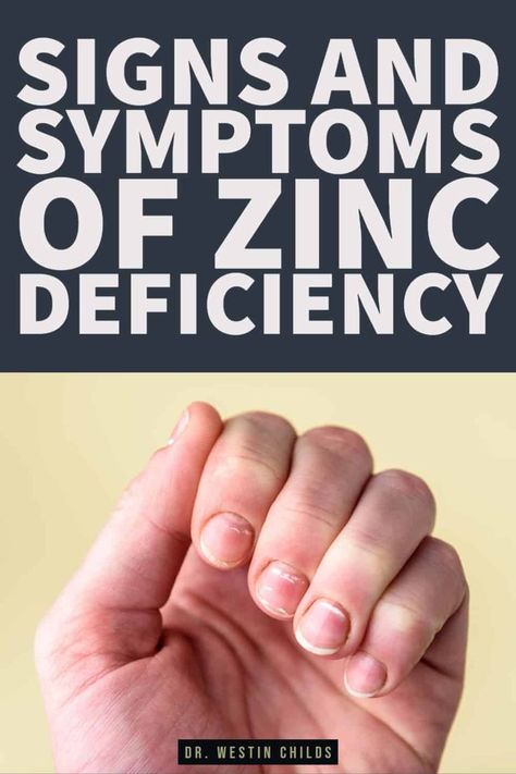 Understanding Zinc Deficiency and Sub-Optimal Zinc Levels https://youtu.be/BX3eT2UZR-s Zinc is considered an essential mineral for the body. This means that you cannot live without zinc, it is ESSENTIAL or REQUIRED for life! This means that | Zinc Deficiency Symptoms, Nerve Pain Remedies, Natural Thyroid Remedies, Zinc Benefits, Low Thyroid Remedies, Thyroid Remedies, Thyroid Supplements, Zinc Rich Foods, Deficiency Symptoms Zinc Deficiency Symptoms, Nerve Repair, Natural Thyroid Remedies, Zinc Benefits, Low Thyroid Remedies, Nerve Pain Remedies, Thyroid Remedies, Thyroid Supplements, Zinc Rich Foods