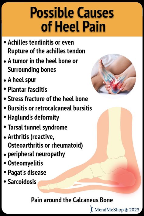 Heel pain is one of the most common causes of lower back pain. It can also cause pain in the calf and thigh. Heel pain can occur when you push off your toes or when you bear weight on your heels, but it usually occurs at the end of a long day on your feet. Causes of heel pain Heel pain may be caused by many different factors, including: Achilles tendonitis or Achilles tendon rupture (rupture) Plantar fasciitis (inflammation of the plantar fascia) Tarsal tunnel syndrome There are more! Achilles Tendon Pain Relief, Essential Oils For Tendon Inflammation, Healing Achilles Tendon, Heel Pain Exercises, Achilles Bursitis, Heel Bursitis, Haglunds Deformity, Achilles Tendon Ruptures, Pain Is Weakness Leaving