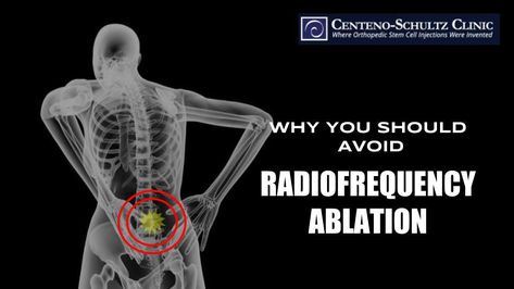 Why We Don't Perform the Radiofrequency Ablation Procedure Bursitis Hip, Regenerative Medicine, Killer Heels, Low Back Pain, Radio Frequency, Medical History, Stem Cells, Neck Pain, History Books