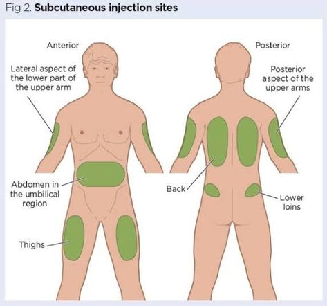 Injection Nursing, Subcutaneous Injection, Nursing School Essential, Subcutaneous Tissue, Nursing School Tips, Learning Support, Nurses Day, Nursing Notes, School Hacks