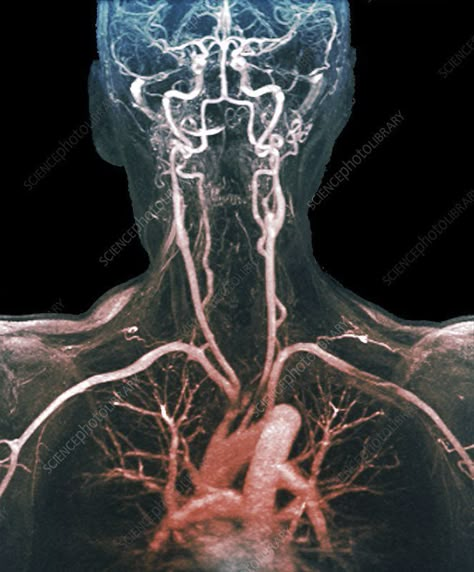 Bio Art, Human Anatomy Art, Ap Art, The Human Body, Anatomy Art, Human Anatomy, Lungs, Blood Vessels, Halle