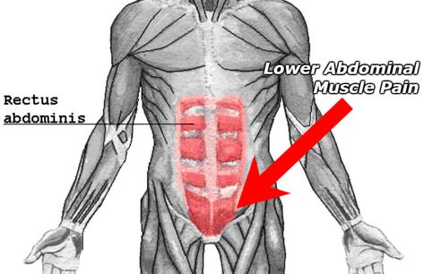 lower abdominal muscle pain diagram Stomach Muscles Anatomy, Abdominal Muscles Anatomy, Lower Abdominal Workout, Muscle Diagram, Lower Workout, Muscle Belly, Muscles Anatomy, Lower Abdominal Pain, Stomach Remedies