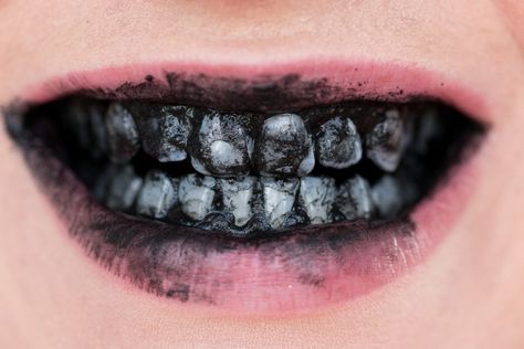 Naturally Whiten Teeth, Sunburn Peeling, Teeth Aesthetic, Losing Teeth, Gore Makeup, Black Teeth, Natural Face Care, Dental Fun, Aesthetic Dentistry