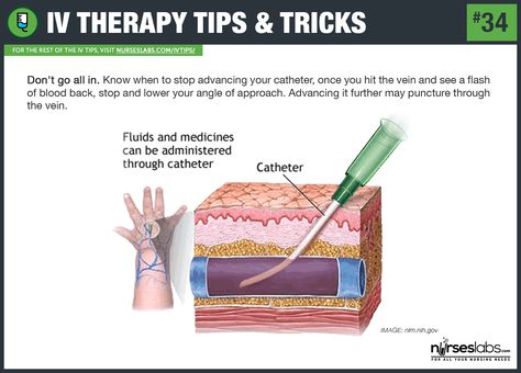 50 Intravenous Therapy (IV) Tips and Tricks For Nurses: http://nurseslabs.com/50-intravenous-therapy-iv-tips-tricks/ Iv Needle, Nursing Iv, Iv Insertion, Nursing Cheat, Intravenous Therapy, Nursing Student Tips, Nursing School Survival, Nursing School Tips, Iv Therapy