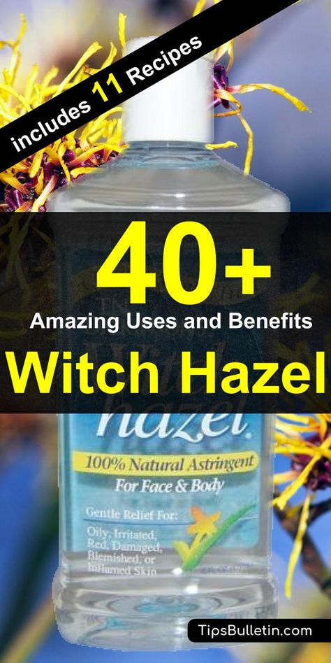 Witch Hazel For Acne, Witch Hazel Acne, Witch Hazel Uses, Acne Face, Natural Healing Remedies, Diy Remedies, Face Beauty, Natural Therapy, Witch Hazel