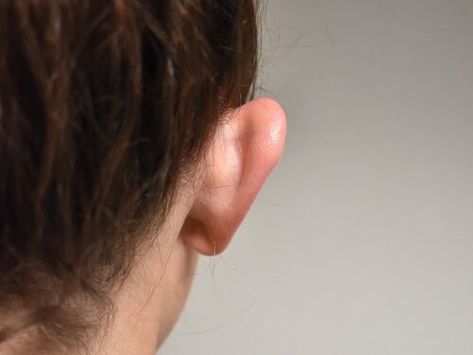 Ear Front View, Ear Reference Photo, Ear Drawing Reference, Ear References, Mermay Inspiration, Ears Reference, Ear Photo, Ear Surgery, Ear Picture