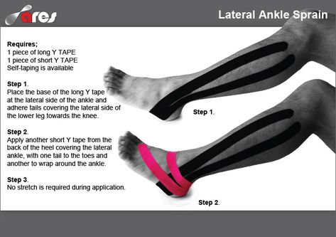 Healing Stretches, Ankle Sprain Recovery, Bursitis Elbow, Muscular Anatomy, Knee Taping, Sky Running, Ankle Taping, Peroneus Longus, Achilles Pain