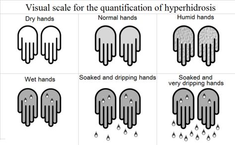 Hyperhydrosis Hands, How To Reduce Sweating, Hand Soak, Sweaty Palms, Stop Sweating, Stop Overeating, Dark Eye Circles, Physical Intimacy, Excessive Sweating