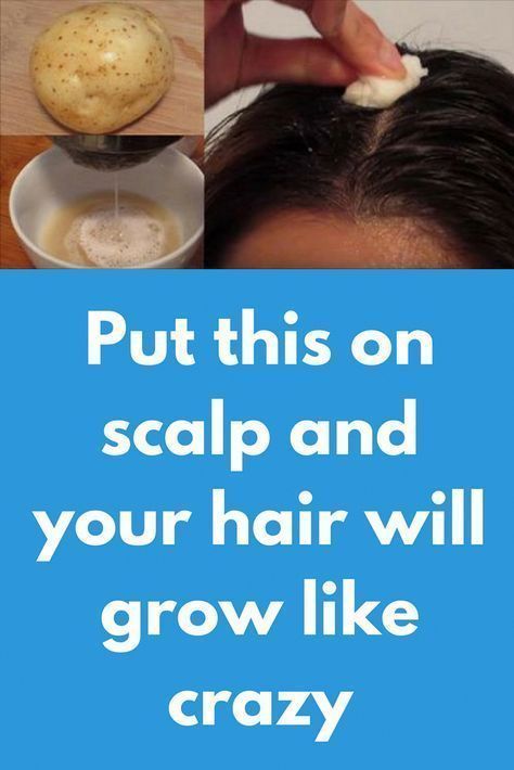 Thick Hair Remedies, How To Grow Your Hair Faster, Hair Remedies For Growth, Home Remedies For Hair, Regrow Hair, Baking Soda Shampoo, New Hair Growth, Grow Hair Faster, Hair Growth Faster