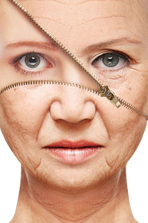 Remove Skin Tags Naturally, Skin Wrinkles, Green Tea Face, Anti Aging Secrets, Beauty Clinic, Face Wrinkles, Wrinkled Skin, Loose Skin, Wrinkle Remover