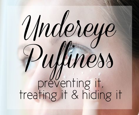 The best tips and tricks to depuff the bags under your eyes and correct and then conceal your undereye bags and puffiness! Undereye Bags, Eye Puffiness, Under Eye Puffiness, Eye Creams, Under Eyes, Makeup Tricks, Under Eye Bags, Puffy Eyes, Clever Crafts