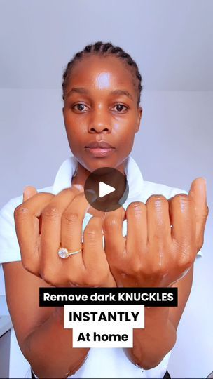 356K views · 3.4K reactions | Remove dark knuckles instantly at home with only two ingredients. #knuckles #skincare #handcare #diy #organicskincare #fypシ゚ #fypviralシ #viralvideoシ #viralshorts #reelsfbシ #fb | Aroma Talks | Aroma Talks · Original audio How To Remove Dark Knuckles, Dark Knuckles, Diy Skin Care Routine, Diy Skin Care, Diy Skin, Hand Care, Black Women Fashion, Care Routine, Organic Skin Care