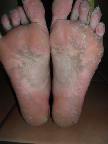 Dead Skin Acid Peel for your feet. (Kitchen Cabinet Remedy!) - Pamper Parties Pittsburgh Acid Peel, Peeling Mask, Foot Soak, Peeling Skin, Homemade Beauty Products, Health And Beauty Tips, Beauty Treatments, Dead Skin