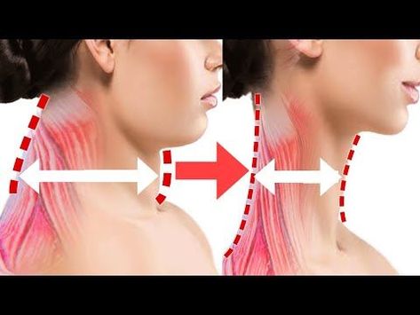 Slim Neck And Shoulders Exercise, How To Slim Neck And Face, Exercise For Neck Double Chin, Neck Exercises For Long Neck, How To Make My Neck Thinner, Neck Slim Exercise, Neck Fat Loss Exercise, Tall Neck Exercise, Chin And Neck Exercises