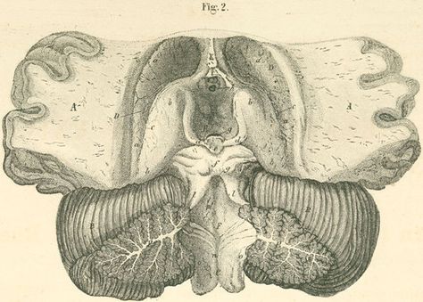 The opened ventricle of the brain, seen from above Anatomy And Physiology, Anatomy Reference, Human Anatomy, The Brain, Anatomy, Brain, Temple, Humanoid Sketch, Human