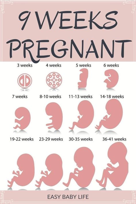 What does my baby look like at 9 weeks pregnant? Read all about baby size and looks and what is going on inside your baby bump during week nine of your pregnancy. Follow your first trimester week by week at www.easybabylife.com. Size Of Baby Week By Week, 30 Weeks Pregnant Belly, 9 Weeks Pregnant Symptoms, Baby Size By Week, 7 Weeks Pregnant, 9 Weeks Pregnant, First Week Of Pregnancy, 5 Weeks Pregnant, Trimester By Weeks