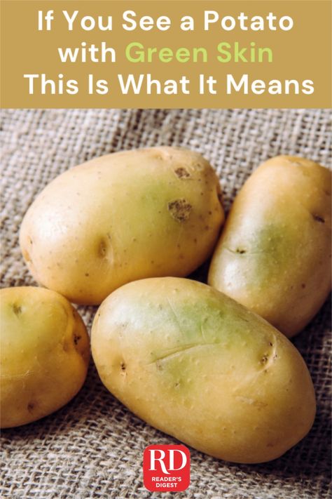 Are green potatoes safe to eat? We dug into the science to find out. Potato With Eyes, Boiled Red Potatoes, Sack Of Potatoes, Benefits Of Potatoes, Green Potatoes, Canned Potatoes, Eat Green, Potato Skin, Idaho Potatoes