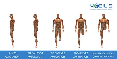 Lightweight prosthetic leg in UAE, Lightweight prosthetic leg, Lightweight prosthetic leg in Dubai, Prosthetic leg in UAE, Prosthetic leg in Dubai, Prosthetic leg Prosthetic Limbs, Prosthetic Leg, Physical Therapist, Physical Therapy, Above Knee, Anatomy, Vocabulary, Things That, Writing