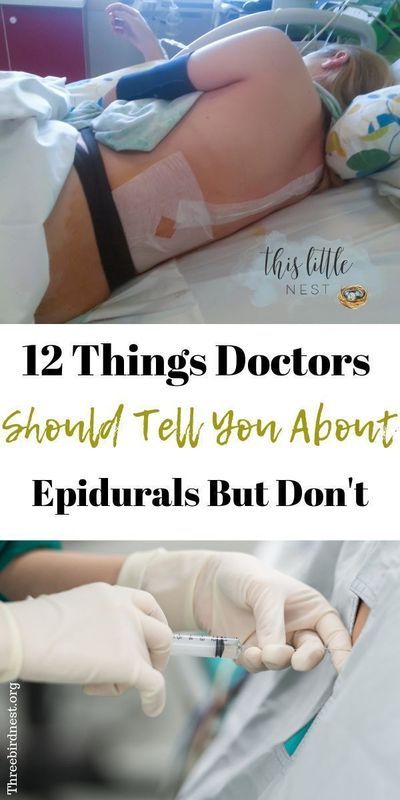 Epidurals are the standard in labor pain relief but they do have consequences you need to know about. Click to find out more and have a look at the featured gifs of several pregnancy stories. #epidural #epidurals #childbirth #pregnancy #labor Epidural Side Effects, Baby Kicking, Pregnancy Information, Pumping Moms, Baby Sleep Problems, In Hospital, Baby Tips, First Pregnancy, After Baby