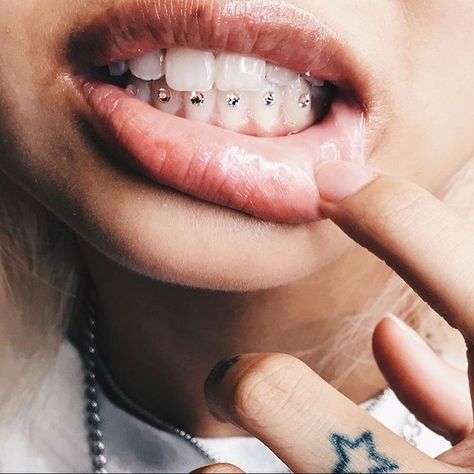 Piercing no dente (Foto: Reprodução/ Instagram @dr.walterzahnarztpraxis) Dental Jewelry, Tooth Jewelry, Grillz Teeth, Diamond Teeth, Tooth Gems, Teeth Bleaching, Smiley Piercing, Gold Grillz, Grills Teeth