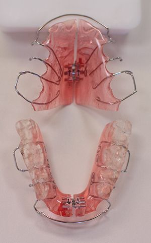 Functional appliances used in orthodontics Orthodontics Aesthetic, Braces Girl, Braces Retainer, Retainer Teeth, Dental Retainer, Braces Tips, Dental Posters, Orthodontic Appliances, Dental Aesthetics