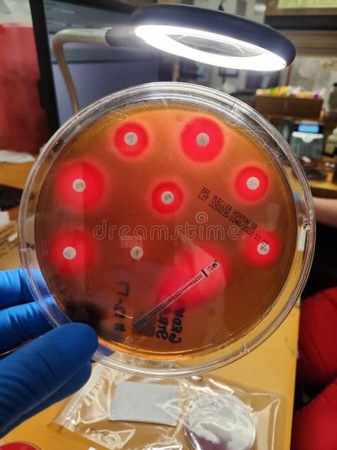 Streptococcal bacterial colonies on blood agar culture plates royalty free stock photos Abo Blood Group System, Blood Under Microscope, Types Of Blood Cells, Wbc Blood Cells, Kirby, Free Stock Photos, Royalty Free Stock Photos, Photo Image, Lab