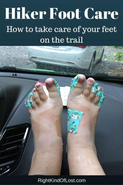 Hiker foot care – how to take care of your feet before and during your hike to prevent blisters, swelling, and other types of pain. How To Get Rid Of Blisters On Feet Fast, Athletes Feet Remedy, Apocalypse Journal, How To Heal Blisters On Feet Fast, Taking Care Of Your Feet Tips, Blister Care, Functional Non-slip Sandals For Hiking, Hand And Foot Care, Prevent Blisters