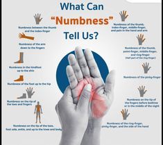 How can we stop numbness? Numbness is usually caused by nerve damage or lack of blood supply to a part of the body. Yoga poses such as neck stretches, back stretches – help to reduce numbness & restore the blood supply Going Numb, Tingling Hands, Arm Numbness, Swollen Hands, Nerve Pain Remedies, Carpel Tunnel, Numbness In Hands, Leg Ulcers, Nerve Health