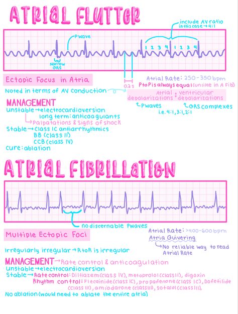 Ekg Notes Nursing Students, Ems Study Notes, Paramedic School Notes, Ekg Notes, Ekg Interpretation Made Easy, Medical Study Notes, Ekg Nursing, Ekg Tech, Ekg Technician