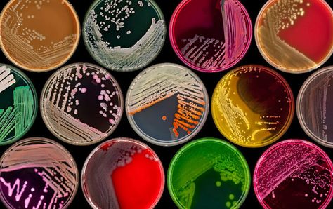 14 | Photos Showcase The Hidden Beauty Of Dread Diseases | Co.Create | creativity + culture + commerce Lab Week, Petri Dishes, Medical Laboratory Science, Bio Art, Lab Tech, Petri Dish, Hidden Beauty, Weird Science, Laboratory Science