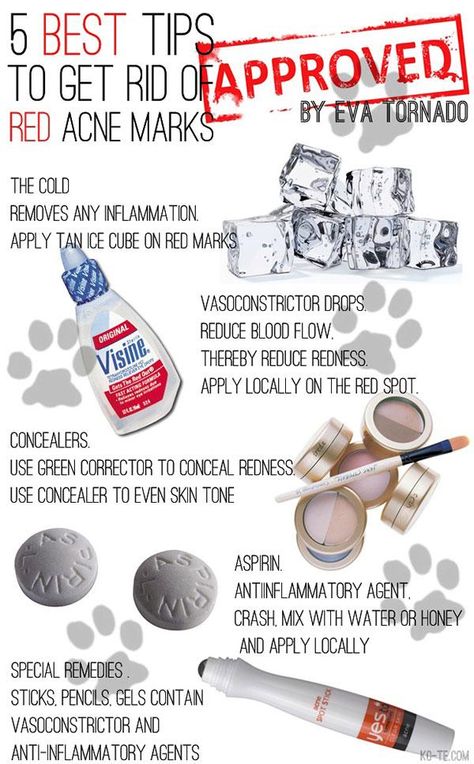 Embedded image permalink Cover Up Pimples, Red Acne Marks, Face Remedies, Eye Makeup Glitter, Acne Hacks, Warts On Face, Awesome Inventions, Brown Age Spots, Acne Tips