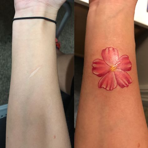 Scar cover up pink flower forearm tattoo Flower Tattoo Over Scar, Arm Scar Tattoo Coverup Sleeve, Arm Scar Tattoo Coverup, Flower Tattoo To Cover Up Scar, Arm Lift Scar Tattoo Cover Up, Scar Cover Up, Forearm Tattoo, Little Tattoos, Forearm Tattoos