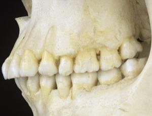 New scientist- human evolution Teeth Side View, Homo Floresiensis, Homo Heidelbergensis, Rotten Teeth, Brain Size, Mitochondrial Dna, Biology Resources, Dental Facts, Human Evolution