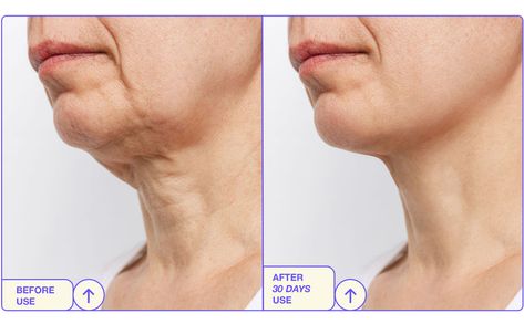 2024's 5 Best Neck Firming Creams — CLEAN BEAUTY INSIDER Sagging Jowls, Anti Aging Neck, Neck Necklace, Neck Firming, Turkey Neck, Revision Skincare, Firming Cream, Vitamins For Skin, Neck Cream