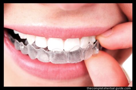 Foods to Avoid When You Have Metal Braces vs. Invisalign Braces Clear Aligner, Clear Retainers, Ceramic Braces, Fix Teeth, Braces Cost, Invisalign Aligners, Invisalign Braces, Teeth Alignment, Invisible Braces