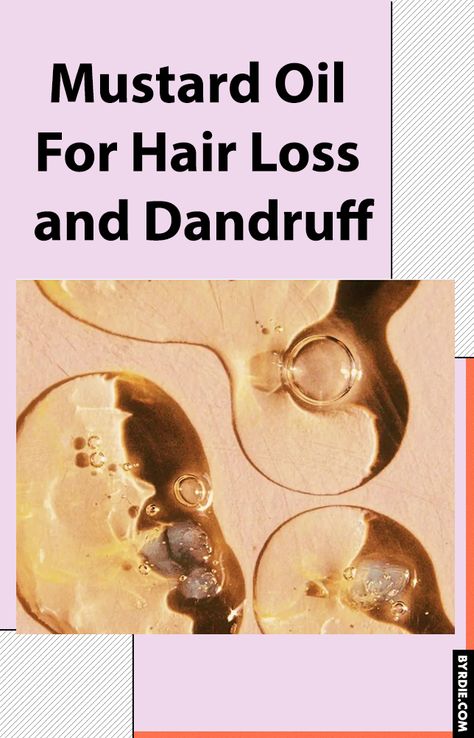 Mustard Oil For Hair Growth, Help With Dandruff, Mustard Oil For Hair, Mustard Seed Oil, Home Remedies For Dandruff, Oils For Dandruff, Dandruff Remedy, Dry Curly Hair, Winter Hair Color Ideas