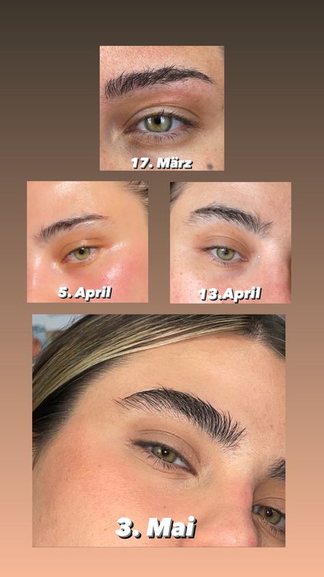 My eyebrows grow so fast 😱 How To Grow Brows Fast, How To Grow Thick Eyebrows, Eyebrow Growth Before And After, How To Make Your Eyebrows Grow, How To Grow Eyebrows Faster, Growing Eyebrows, Grow Eyebrows Faster, Regrow Eyebrows, Grow Eyebrows