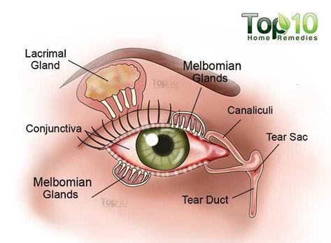 dry eye diagram Dry Eye Remedies, Dry Eyes Causes, Dry Eye Symptoms, Top 10 Home Remedies, Dry Eye, Eye Exercises, Vision Eye, Eyes Problems, Hair Solutions