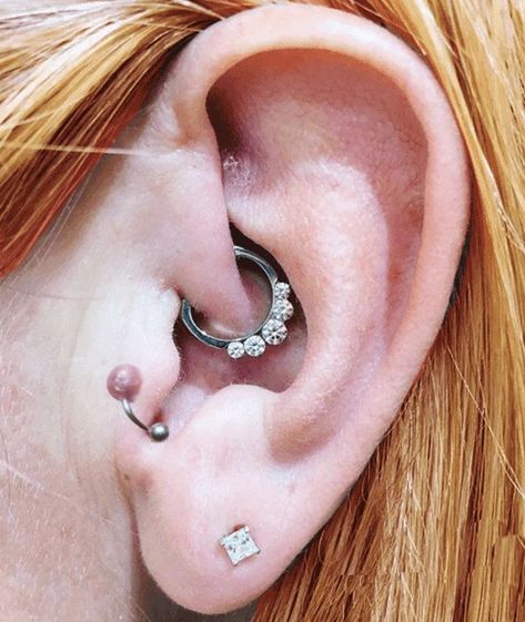 Eliminating Mystery Bumps | Nose & Ear Cartilage Piercings | Piercing bump, Cool ear piercings, Cartilage piercing infection How To Get Rid Of Keloids On Ear, Piercing Bump Remedy, Cartilage Piercing Infection, Infected Ear Piercing, Claires Ear Piercing, Nose Piercing Bump, Cleaning Piercings, Piercing Bump, Ear Piercings Chart