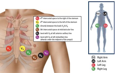 Ekg Placement, Ekg Leads, Phlebotomy Study, Emt Study, Er Tech, Ekg Interpretation, Medical Assistant Student, Nurse Study, Nurse Study Notes