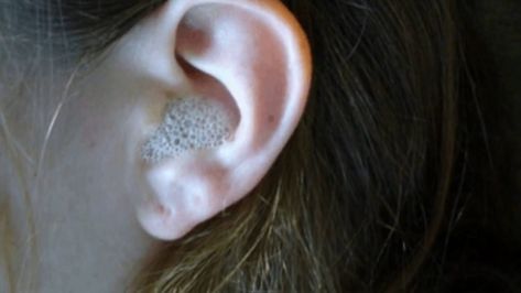 50 Genius Uses And Hacks For Rubbing Alcohol Swimmers Ear, Peroxide Uses, 1000 Lifehacks, Hydrogen Peroxide Uses, Cleaning Your Ears, Dog Diy, Ear Infections, Ear Cleaner, Ear Wax