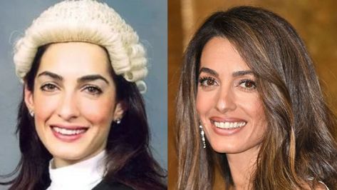 Many people believe Amal Clooney’s stunning face is the result of plastic surgery. She has reportedly received Botox injections, facelifts, eyelid surgery, fillers, and even rhinoplasty. However, the truth has yet to be revealed. Eyelid Filler, Botched Plastic Surgeries, Kardashian Plastic Surgery, Botched Plastic Surgery, Bad Celebrity Plastic Surgery, Bad Plastic Surgeries, Face Surgery, Rhinoplasty Surgery, Celebrity Plastic Surgery