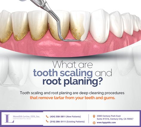 Patients with advanced periodontitis may need tooth scaling and root planing to remove tartar. These treatments are highly effective against gum disease and prevent gum recession and bone and tooth loss. #meredithlevineDDS #centurycity #CA Tooth Scaling, Dental Pictures, Dental Advertising, Dental Cabinet, Dental Social Media, Tartar Removal, Foot Reflexology Massage, Dental Posters, Gum Recession