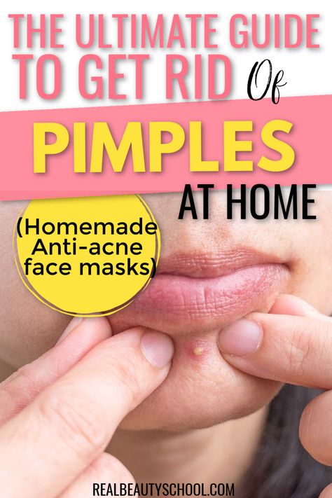 7 Easy DIY Face Masks For Acne Clear Face Tips, Anti Acne Face Mask, Pimple Mask, Get Rid Of Acne Fast, Face Masks For Acne, Face Mask For Pimples, Masks For Acne, Anti Acne Mask, How To Clear Pimples