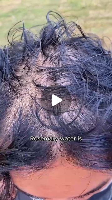 Rosemary Oil Recipe, Thining Hair, Rosemary Water, Hair Growth For Men, Rosemary Oil For Hair, How To Grow Your Hair Faster, Hair Growing Tips, Bald Hair, Skin Care Order