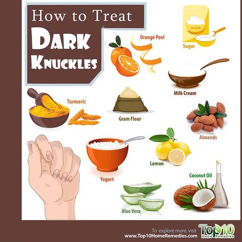 How to Treat Dark Knuckles | Top 10 Home Remedies Dark Knuckles Remedies, Best Skin Lightening Cream, Dark Knuckles, Oily Skin Face, Skincare Diy, Organic Skin Care Routine, Top 10 Home Remedies, Diy Coconut Oil, Hand Moisturizer