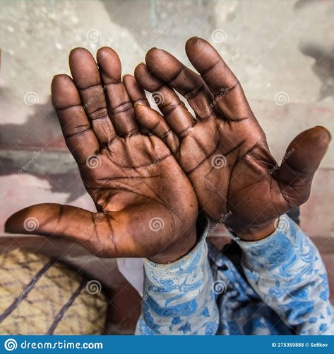 Calloused Hands, Hand Photography, Tell A Story, Body Health, Labor, Farmer, Photo Image, Stock Photos, Skin