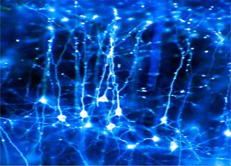 Neurons Brain Neurons, Cerebral Cortex, Rhapsody In Blue, E Mc2, Brain Activities, Anatomy And Physiology, Feeling Blue, Fun Science, Neuroscience